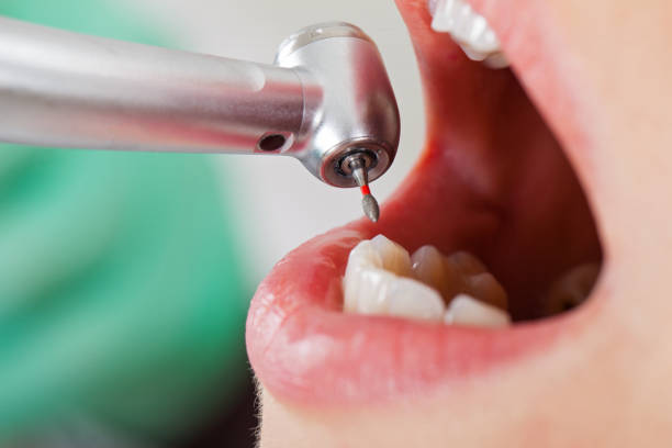 Best Walk-In Emergency Dentist in Rose Hill, NC